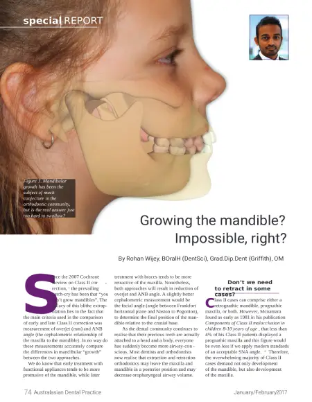 growing-the-mandible