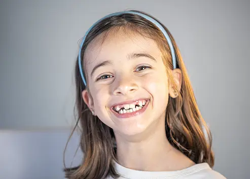 Crowded Teeth and Jaw Imbalance img