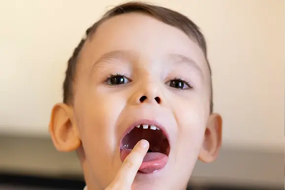 Oral Habits